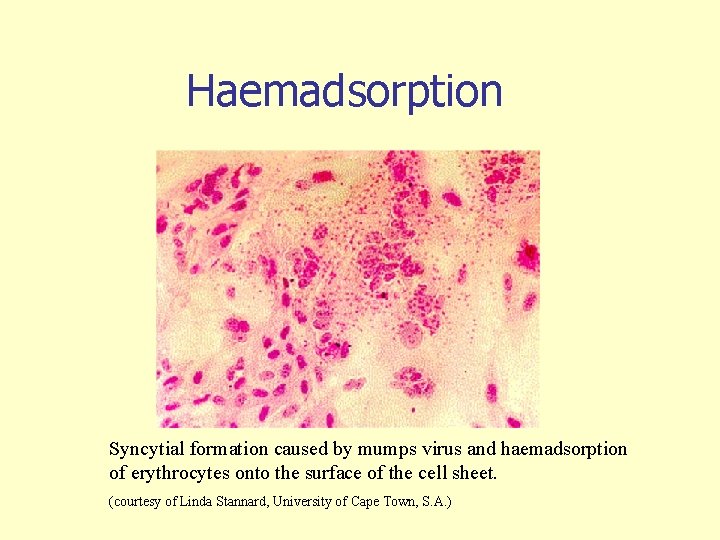 Haemadsorption Syncytial formation caused by mumps virus and haemadsorption of erythrocytes onto the surface