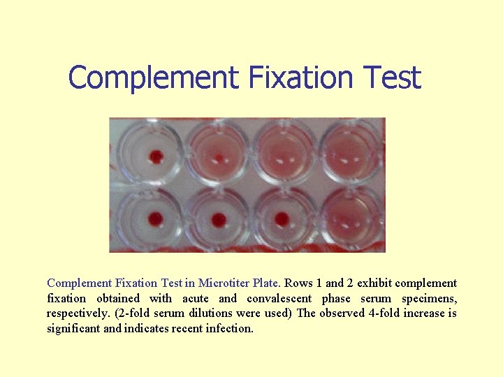Complement Fixation Test in Microtiter Plate. Rows 1 and 2 exhibit complement fixation obtained