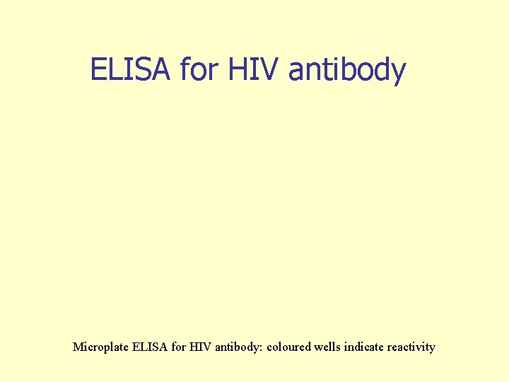 ELISA for HIV antibody Microplate ELISA for HIV antibody: coloured wells indicate reactivity 