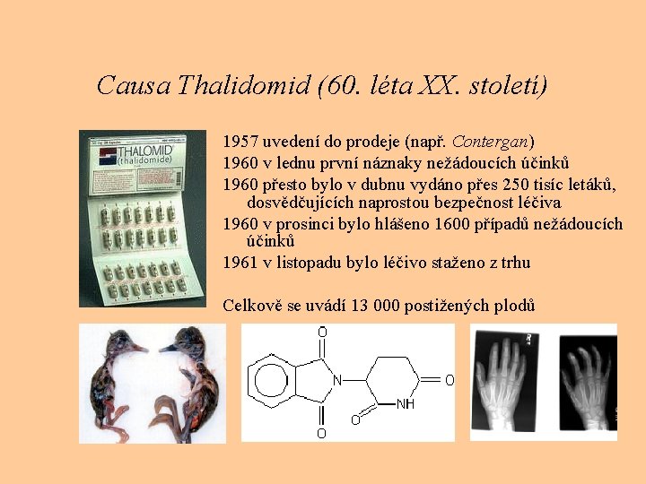 Causa Thalidomid (60. léta XX. století) 1957 uvedení do prodeje (např. Contergan) 1960 v