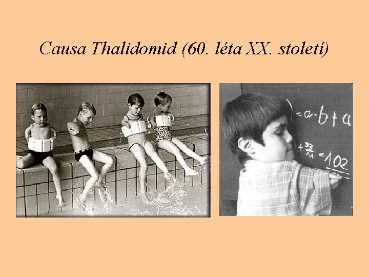 Causa Thalidomid (60. léta XX. století) 