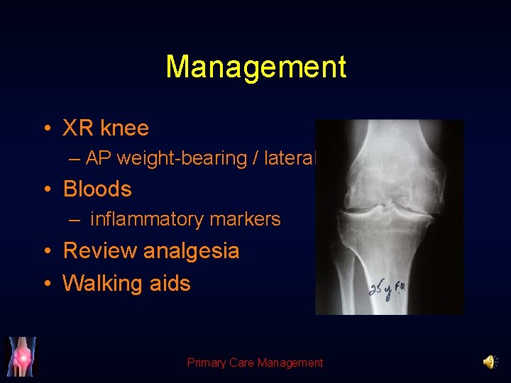 Management • XR knee – AP weight-bearing / lateral • Bloods – inflammatory markers