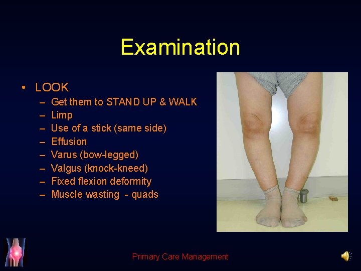 Examination • LOOK – – – – Get them to STAND UP & WALK