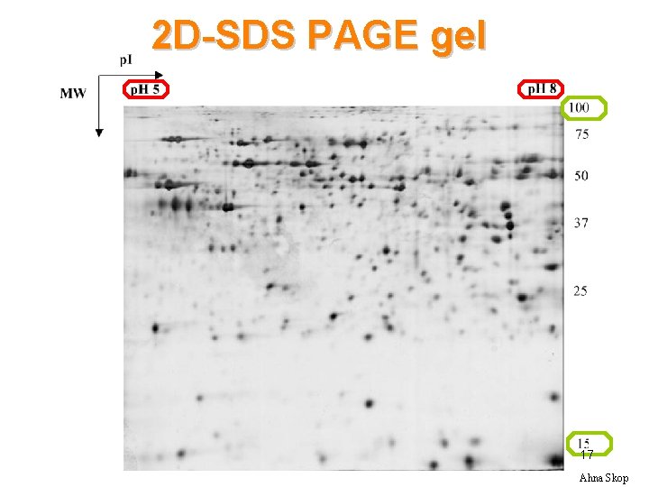 2 D-SDS PAGE gel 17 Ahna Skop 