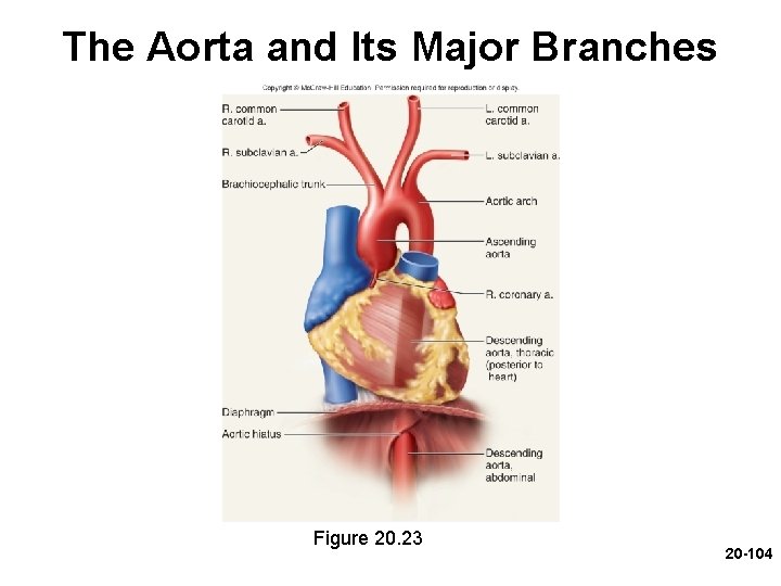 The Aorta and Its Major Branches Figure 20. 23 20 -104 