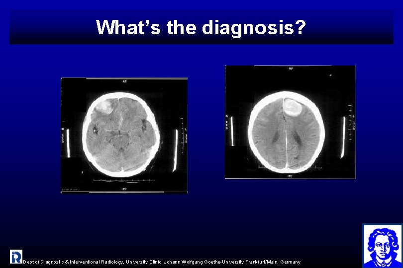 What’s the diagnosis? Dept of Diagnostic & Interventional Radiology, University Clinic, Johann Wolfgang Goethe-University