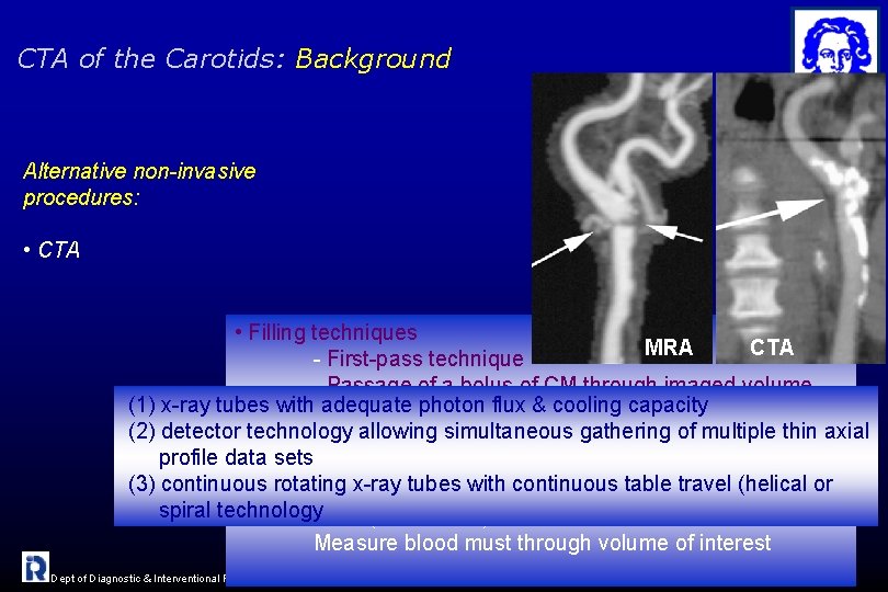 CTA of the Carotids: Background Alternative non-invasive procedures: • CTA • Filling techniques MRA