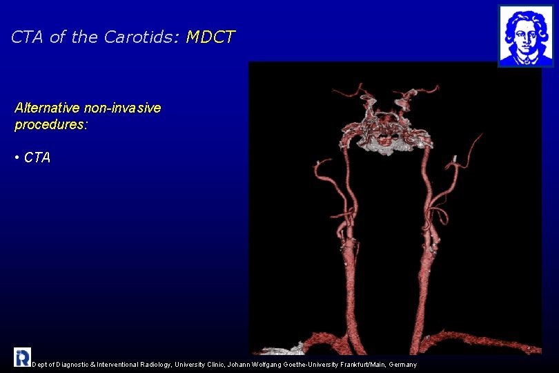 CTA of the Carotids: MDCT Alternative non-invasive procedures: • CTA Dept of Diagnostic &