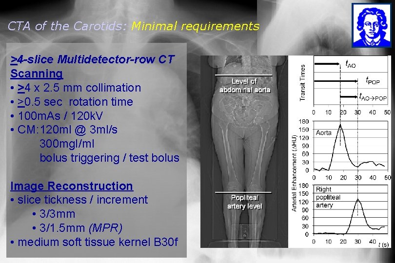 CTA of the Carotids: Minimal requirements >4 -slice Multidetector-row CT Scanning • >4 x