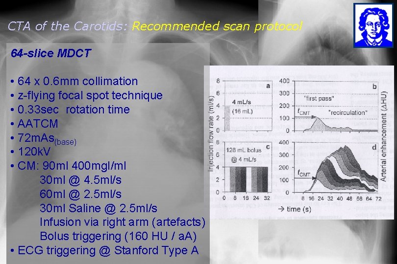 CTA of the Carotids: Recommended scan protocol 64 -slice MDCT • 64 x 0.