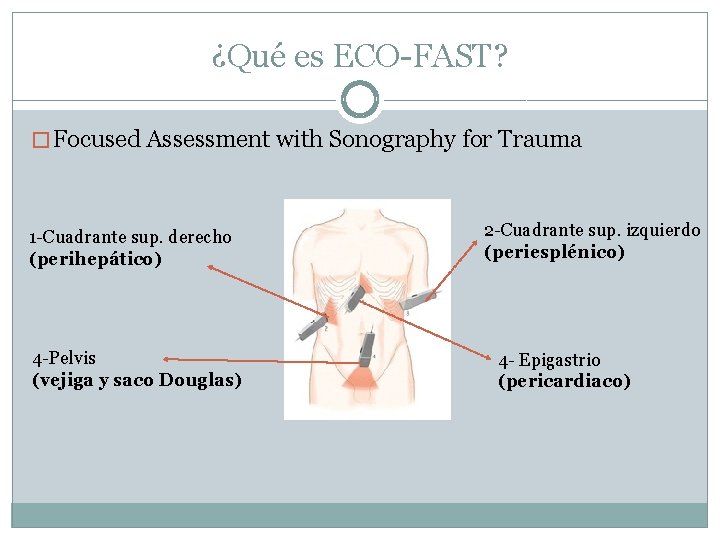 ¿Qué es ECO-FAST? � Focused Assessment with Sonography for Trauma 1 -Cuadrante sup. derecho