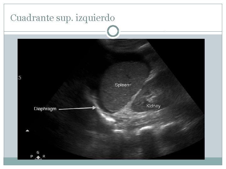 Cuadrante sup. izquierdo 