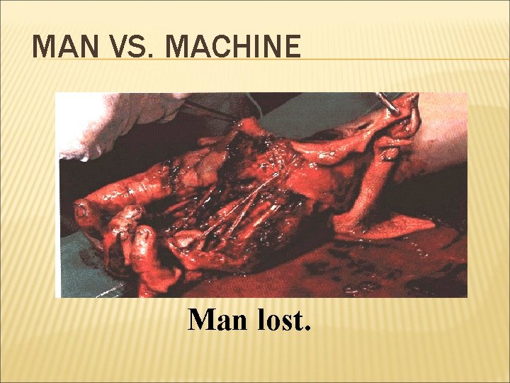 MAN VS. MACHINE Man lost. 