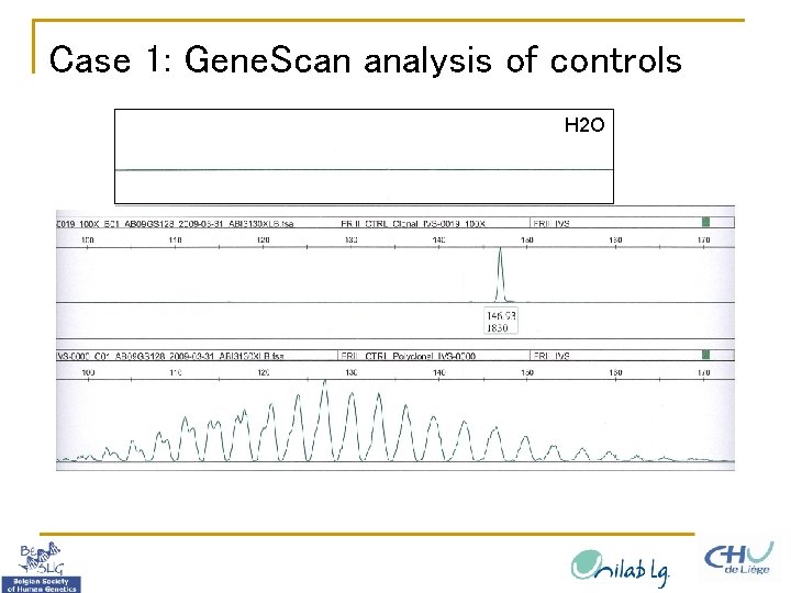 Case 1: Gene. Scan analysis of controls H 2 O 