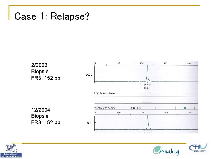 Case 1: Relapse? FR 3 2/2009 Biopsie FR 3: 152 bp 12/2004 Biopsie FR