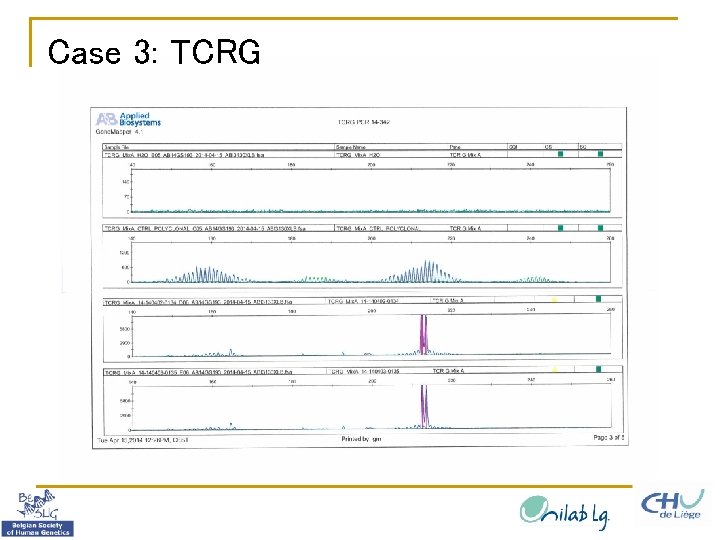 Case 3: TCRG 