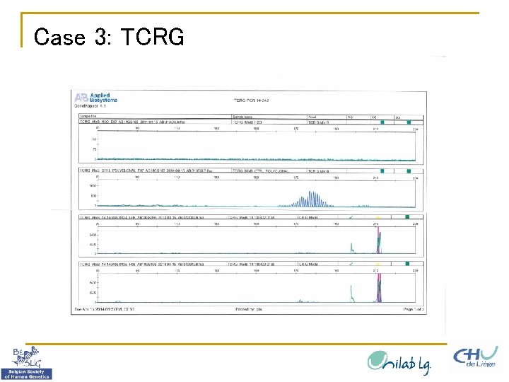 Case 3: TCRG 
