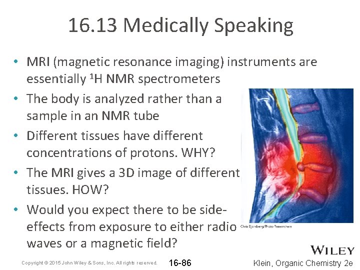 16. 13 Medically Speaking • MRI (magnetic resonance imaging) instruments are essentially 1 H
