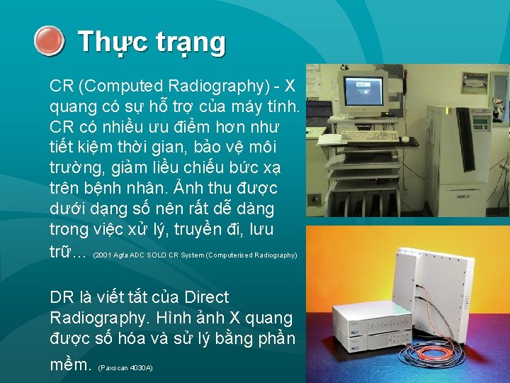 Thực trạng CR (Computed Radiography) - X quang có sự hỗ trợ của máy