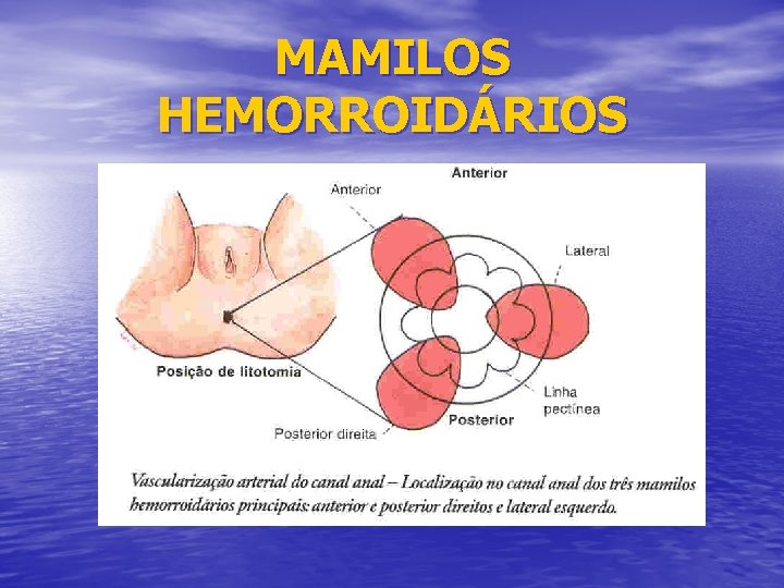 MAMILOS HEMORROIDÁRIOS 