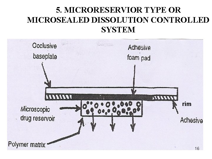 5. MICRORESERVIOR TYPE OR MICROSEALED DISSOLUTION CONTROLLED SYSTEM rim 16 