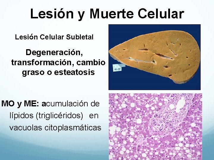 Lesión y Muerte Celular Lesión Celular Subletal Degeneración, transformación, cambio graso o esteatosis MO