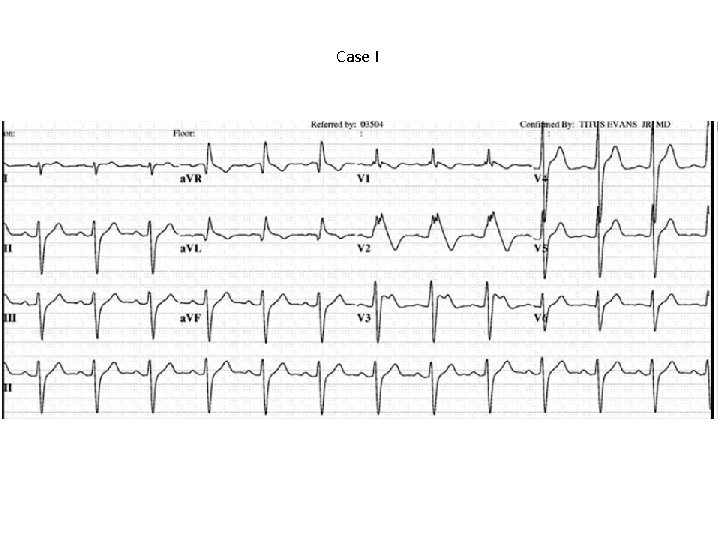 Case I 