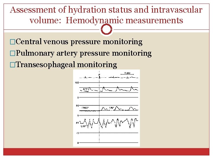 Assessment of hydration status and intravascular volume: Hemodynamic measurements �Central venous pressure monitoring �Pulmonary