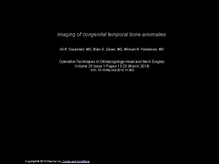 Imaging of congenital temporal bone anomalies Ali R. Sepahdari, MD, Brian D. Zipser, MD,