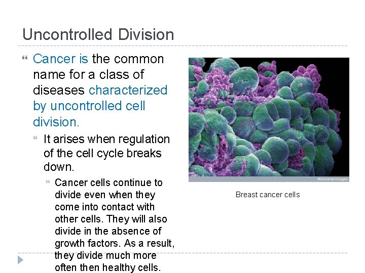 Uncontrolled Division Cancer is the common name for a class of diseases characterized by