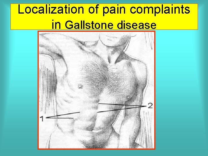 Localization of pain complaints in Gallstone disease 