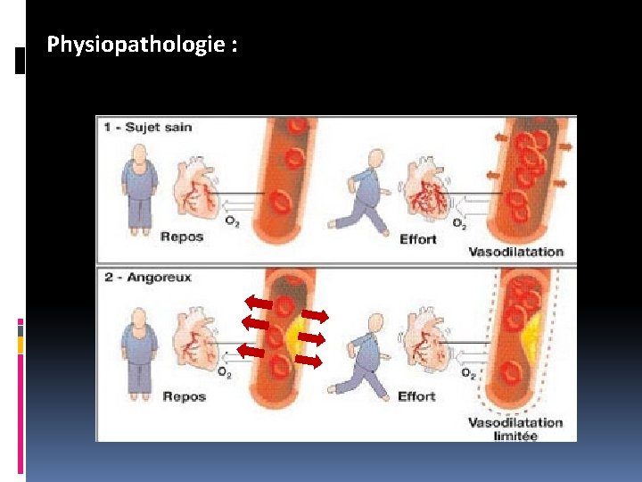 Physiopathologie : Physiopathologie :