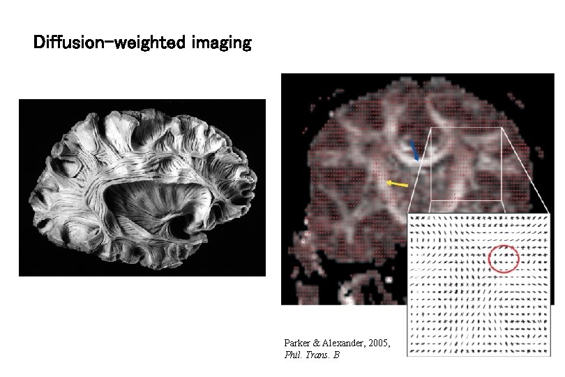 Diffusion-weighted imaging Parker & Alexander, 2005, Phil. Trans. B 