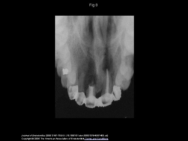 Fig 8 Journal of Endodontics 2005 3167 -70 DOI: (10. 1097/01. don. 0000137645. 87493.