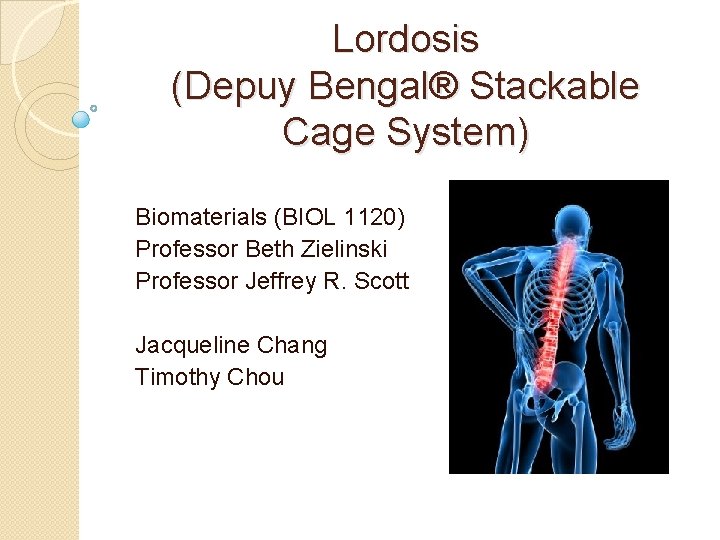 Lordosis (Depuy Bengal® Stackable Cage System) Biomaterials (BIOL 1120) Professor Beth Zielinski Professor Jeffrey