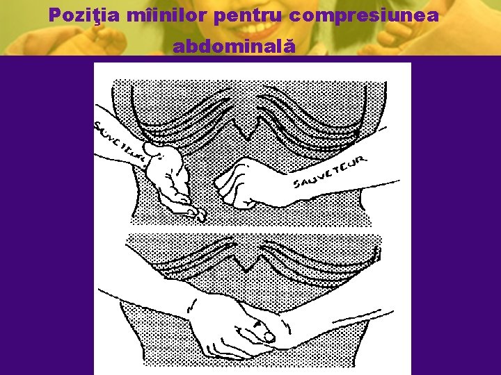 Poziţia mîinilor pentru compresiunea abdominală Poziţia mîinilor pentru compresiunea abdominală