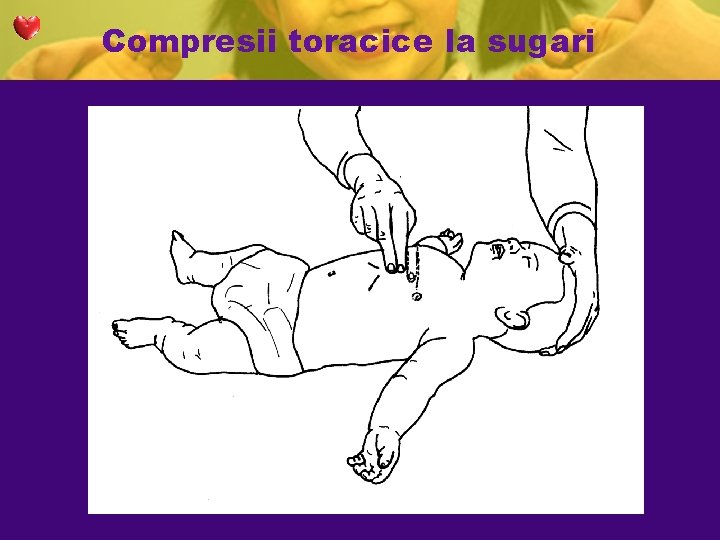 Compresii toracice la sugari Compresii toracice la sugari