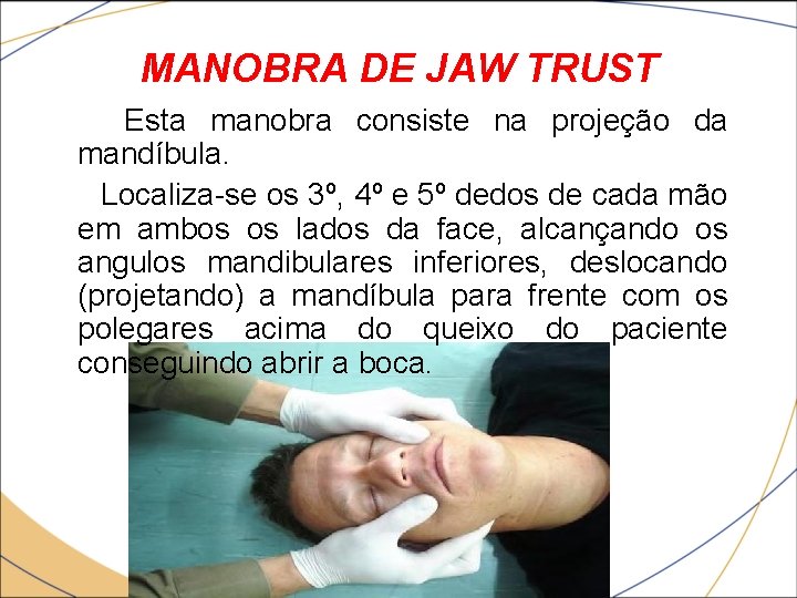 MANOBRA DE JAW TRUST • Esta manobra consiste na projeção da mandíbula. Localiza-se os