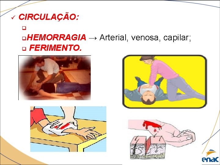 ü CIRCULAÇÃO: q HEMORRAGIA → Arterial, venosa, capilar; q FERIMENTO q 