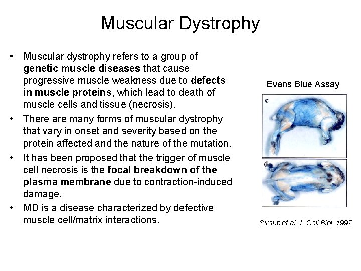 Muscular Dystrophy • Muscular dystrophy refers to a group of genetic muscle diseases that