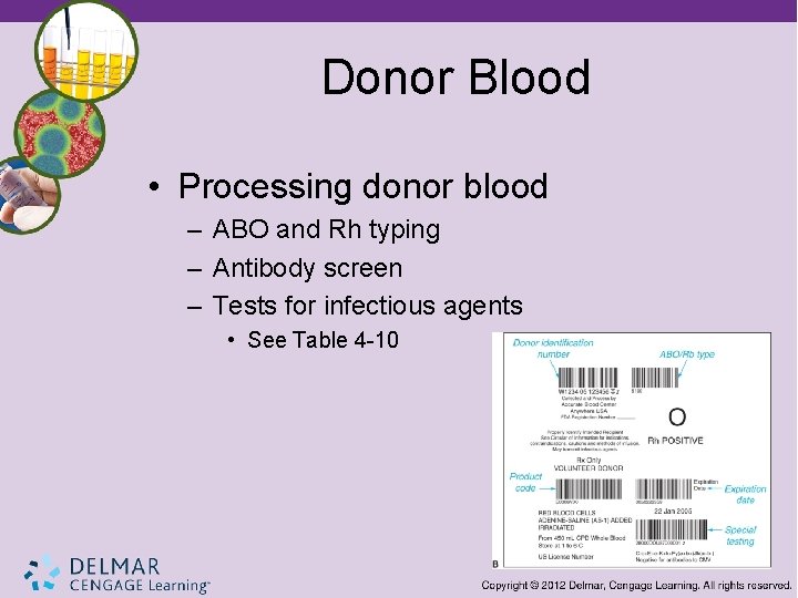 Donor Blood • Processing donor blood – ABO and Rh typing – Antibody screen