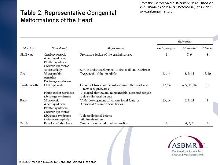 Table 2. Representative Congenital Malformations of the Head © 2008 American Society for Bone