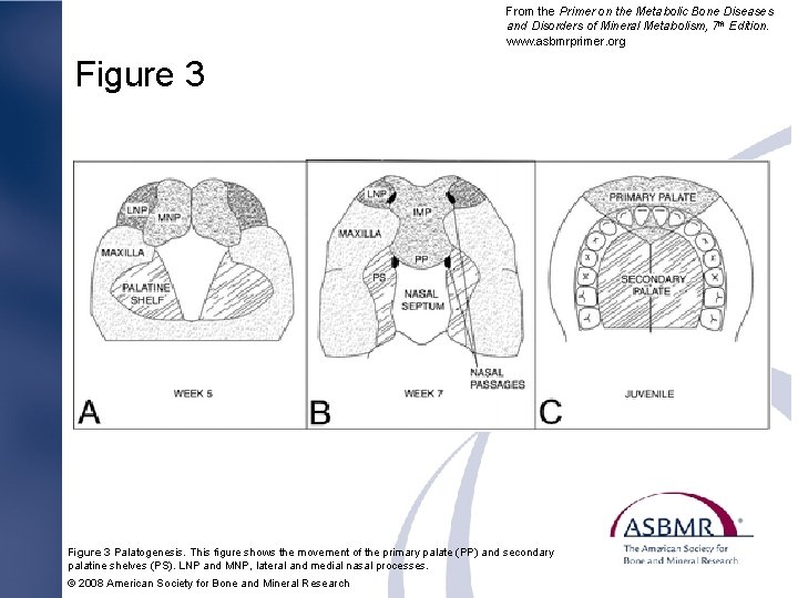 From the Primer on the Metabolic Bone Diseases and Disorders of Mineral Metabolism, 7