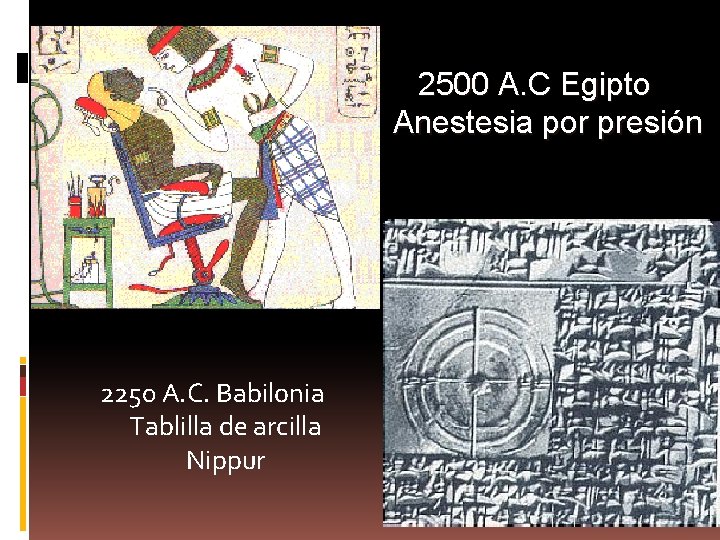 2500 A. C Egipto Anestesia por presión 2250 A. C. Babilonia Tablilla de arcilla