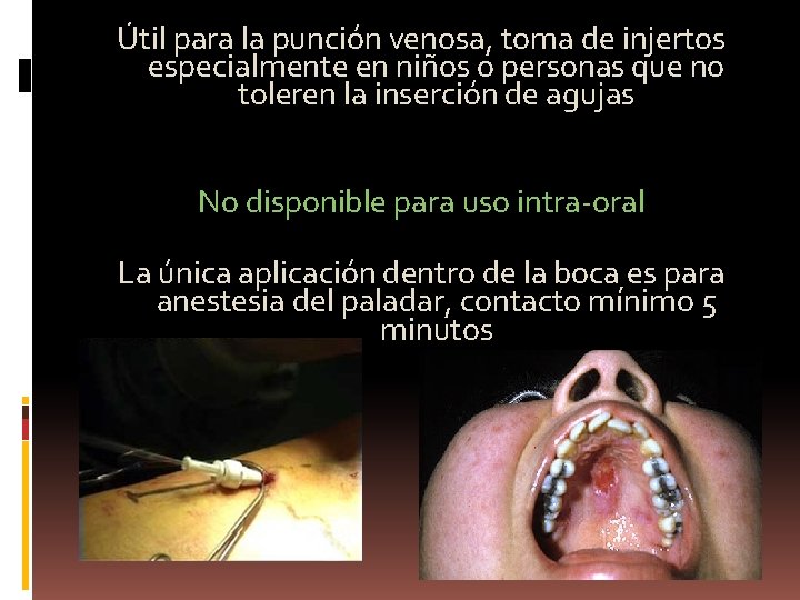 Útil para la punción venosa, toma de injertos especialmente en niños o personas que