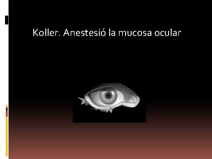 Koller. Anestesió la mucosa ocular 