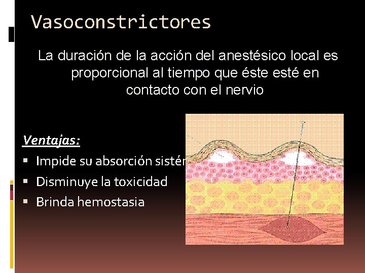 Vasoconstrictores La duración de la acción del anestésico local es proporcional al tiempo que