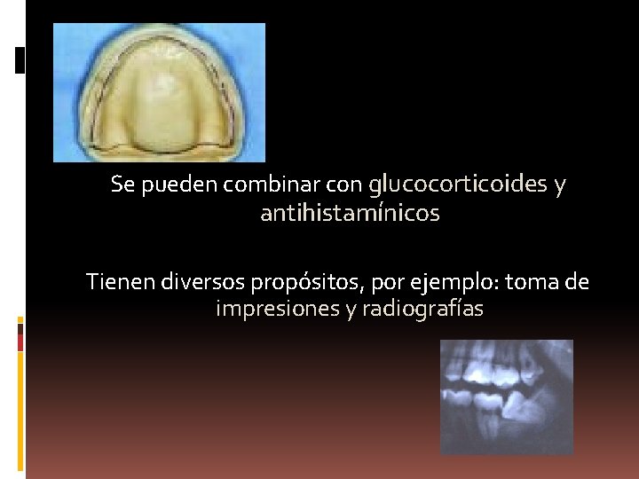 Se pueden combinar con glucocorticoides y antihistamínicos Tienen diversos propósitos, por ejemplo: toma de