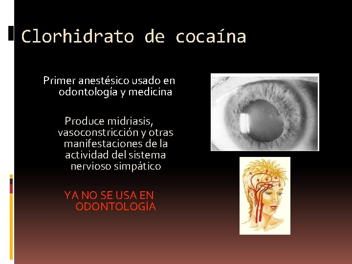 Clorhidrato de cocaína Primer anestésico usado en odontología y medicina Produce midriasis, vasoconstricción y