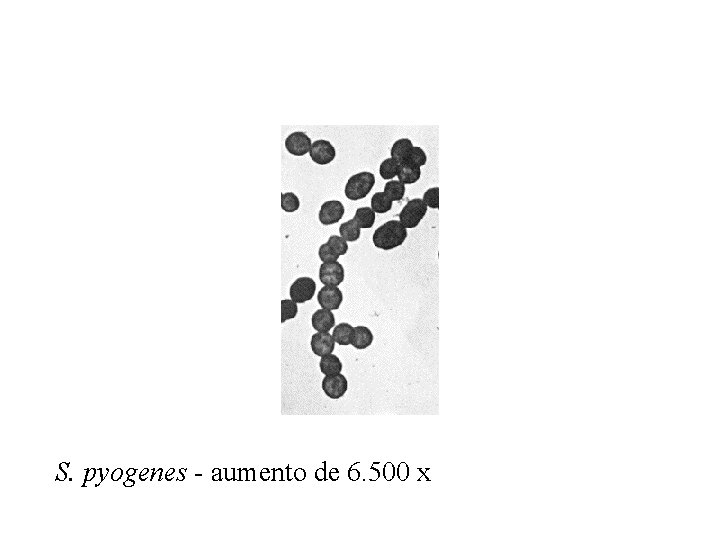 S. pyogenes - aumento de 6. 500 x 